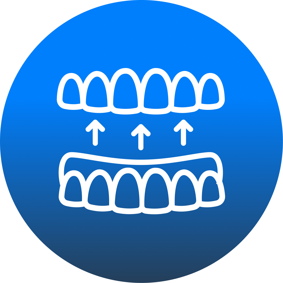 Full Mouth Restoration
